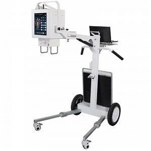 [Hot Item] Portable 5.6kw Moveable Radiography Foldable Digital X-ray Machine with Flat Panel Detector