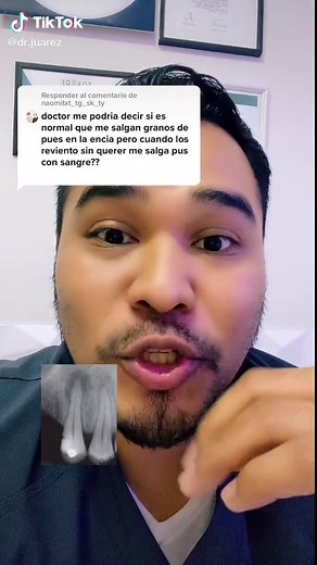 Entendiendo las Postemillas en Ortodoncia