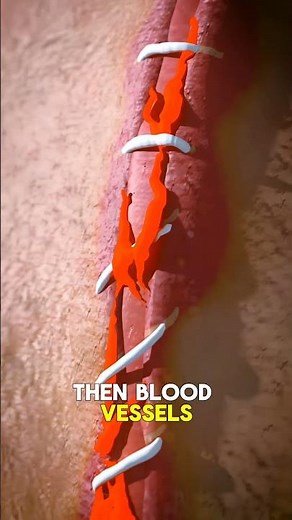 How Stitches Work😱