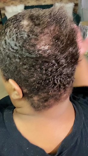 Small Box Braids on VERY SHORT hair!