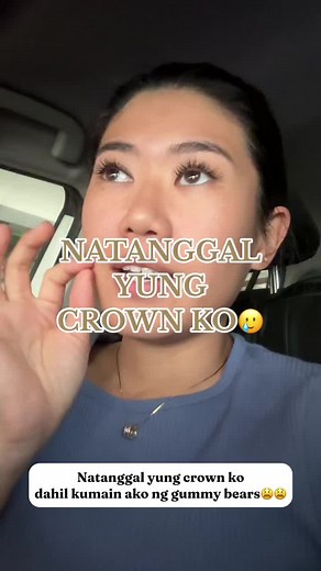 Natanggal yung tooth crown ko the same day i’m leaving for belgium 😫😫😫 #dentist #teeth #funny #traveltiktok #travel