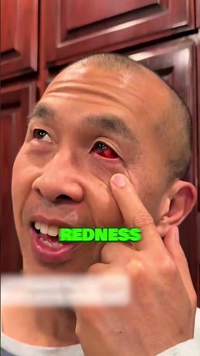 Why Do People Get Red Eyes 👀