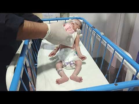 From Tube Feeding to Direct Feeding | Newborn Feeding Journey in NICU | Step-by-Step Clinical Guide