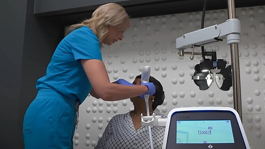 Story from Tixel: New FDA-cleared Tixel i® revolutionizes dry eye relief
