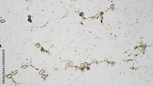 Whole mount of Taenia solium eggs under microscope on white background with 100 times magnification. Macro view of pork tapeworm on scientific slide for studying. Parasites in environment. Pests theme