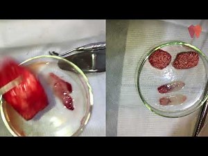 O PRF Avançado do Professor Joseph Choukroun