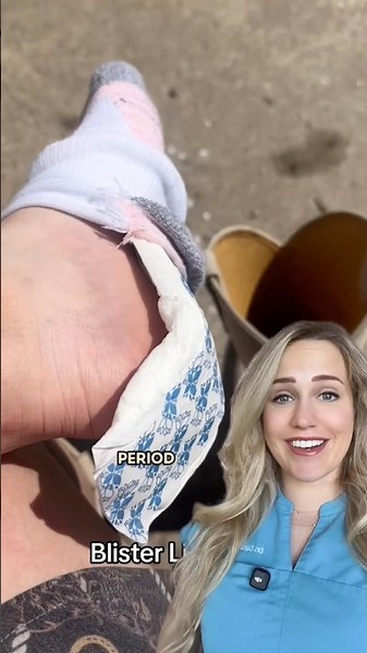 What REALLY causes blisters?