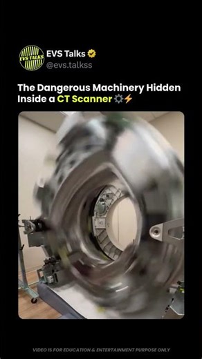 What a CT Scanner Looks Like Without Its Cover 🤯🏥