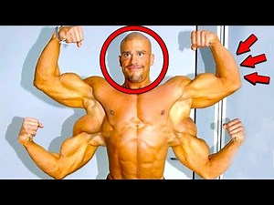 Top 10 Unusual People With Extra Body Parts