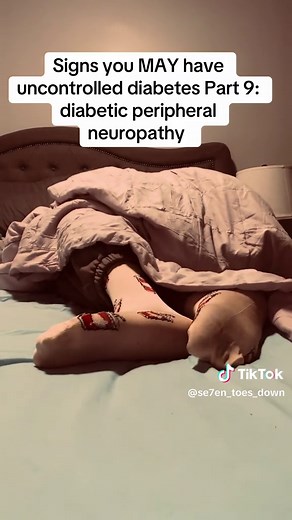Understanding Diabetic Peripheral Neuropathy Symptoms