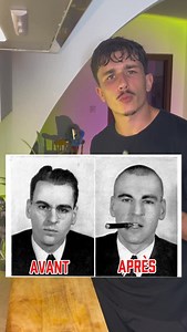 Simon LE GALLIOT - Histoire on Instagram: "Une bien terrible histoire. Sources TED-Ed - One of the most controversial medical procedures in history - Jenell Johnson National Library of Médicine - Prefrontal Lob*tomy in Chronic Schizophrenia [Silent](Bishop Clarkson Memorial Hospital, 1944) Morbid Art History - The Medical Narrative: Before and After NIH Record (Carla Garnett) - When Faces Made the Case for Lobot*my The Washington Post - The Lob*tomist Story Corps - My Lobot*my Dans les années 19