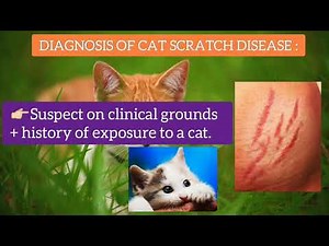 Cat Scratch Disease, Symptoms, Diagnosis, Treatment & Perinaud Oculoglandular Syndrome