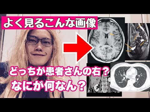 A ZAZY radiologist explains how to read CT and MRI images! [Basics: About the top, bottom, left, ...