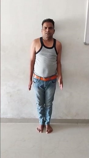 #Gunstock deformity (Cubitus varus )and Cubitus Valgus Deformity#Elbow Fracture