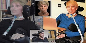 【訃報】人類初のサイボーグ博士64歳で死去!難病ALSで闘病生活