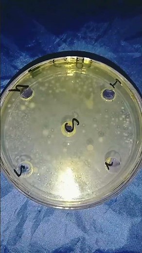 Checking Antibacterial Activity Of Plants Solution/Lab Work