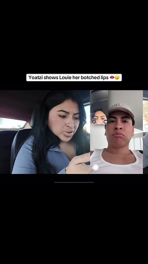 Hilarious Lip Prank on Louie by Yoatzi