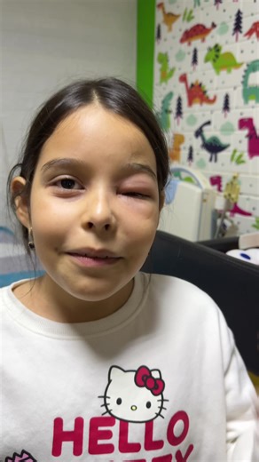 Consecuencias del uso de vaselina en las pestañas