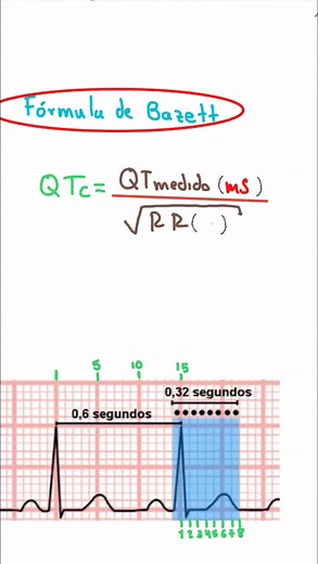 Intervalo QT Corregido: Cálculo y Valores Normales