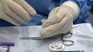 Stent para glaucoma: conheça o implante microscópico promissor no tratamento da doença