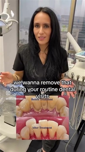 Regular vs. Deep Teeth Cleaning 🦷 | Expert Tips from 20-Year Dental Hygienist Orly