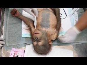 Rescued baby orangutan Didik undergoes surgery to have a bullet removed from his shoulder.