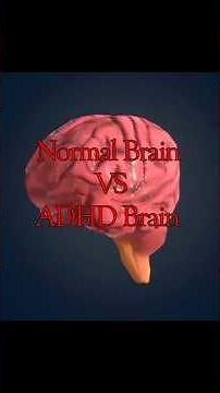 Normal Brain vs ADHD Brain. #shorts #adhdbrain