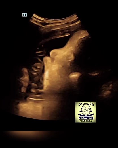 ‏#د_هيثم_عارف #د_هيثم_عارف