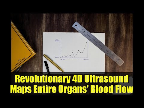 Revolutionary 4D Ultrasound Maps Entire Organs' Blood Flow