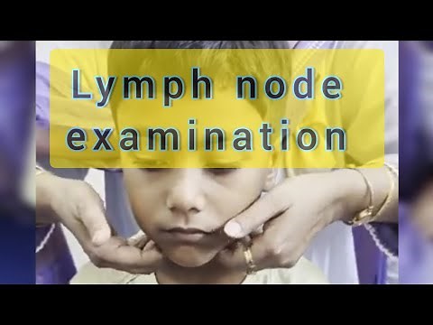 Lymph node examination | paediatrics | examination of lymph node | ‪@sanowarhossain1290‬
