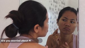 Buddha Natural Anti Acne Natural Soap - 100% Ayush Certified - Cold Pressed Handmade Luxury Butter Soap - Reduce Acne, Pimples - 100 Gms (100.00 G (Pack Of 1) Light Chocolate)