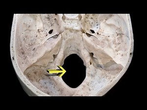 MNEMONIC - Foramen Magnum!