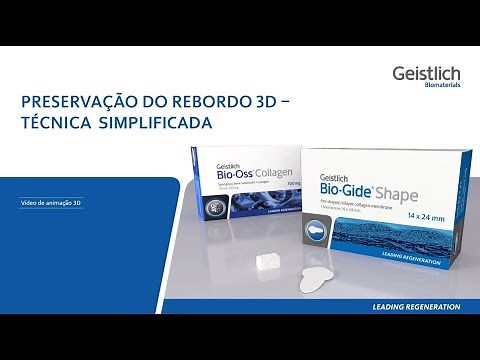 Geistlich Bio-Gide® Shape - Ridge Preservation