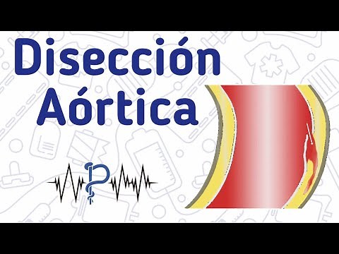 Disección Aórtica - APH Manabí