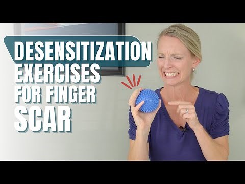 How to Desensitize Your Finger Scar: 3 Quick Tips for a Sensitive Finger Scar
