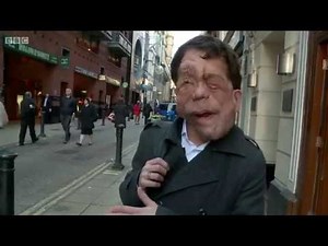 The Ugly Face of Disability Hate Crime - BBC Documentary