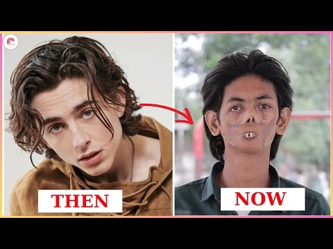 When Celebrities Turn Into Aliens | 25 Most Unbelievable Plastic Surgeries of Hollywood Celebrities