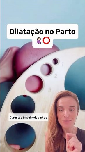 Dilation at Birth - 1 to 10 cm