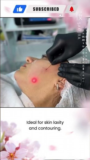 Endolift Laser: Skin Firming, Contouring & Rejuvenation Without Surgery