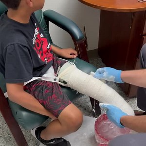 1.3K views · 68 reactions | Here is how we start the process of making an excellent fitting prosthesis. A hand cast is taken and a positive mold is made. Stay tuned for Taylor’s progress! #sabolichstrong #weliveforthis #sabolichprosthetics #championthemoment | Scott Sabolich Prosthetics Ottobock.care | Facebook