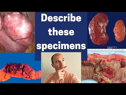 How to describe gross pathology specimens