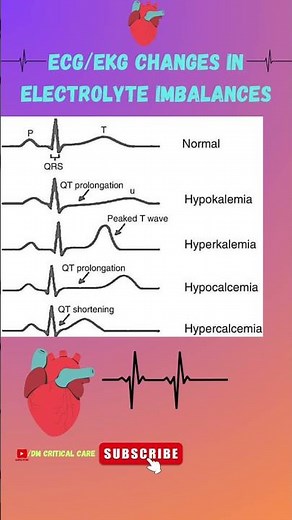 ECG/EKG changes in Electrolyte Imbalances | ECG of Hyper and Hypokalemia,Hyper and Hypocalcemia #ecg