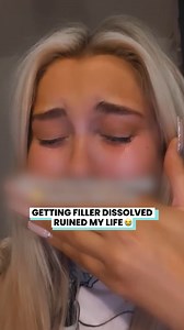 1.5M views · 3.7K reactions | I can’t stop crying after dissolving my mega lips  | Ultimate | Facebook