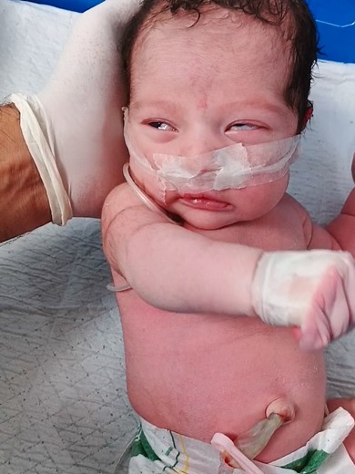 Understanding Neonatal Hypoxic-Ischemic Encephalopathy