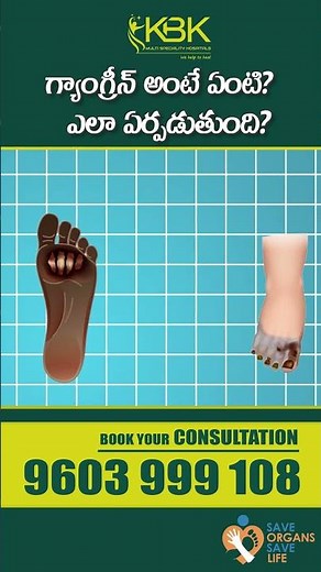 What is gangrene? Different Types of Gangrene | Dr. Aishwarya | KBK Hospitals #gangrene