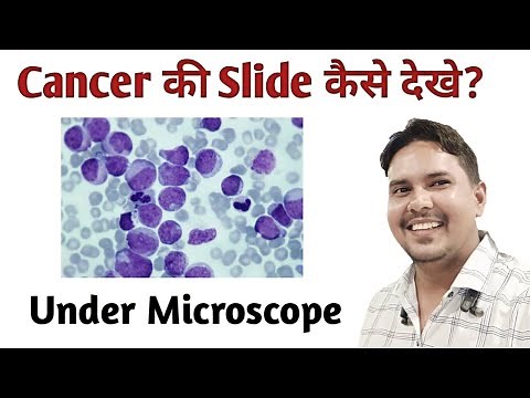 Cancer slide under microscope