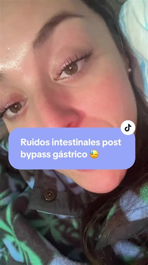 Borborigmos tras bypass gástrico: causas y qué hacer