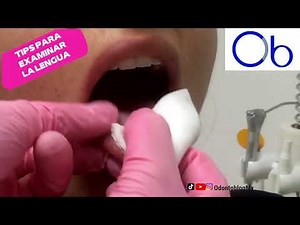 This is how the tongue is examined 👅