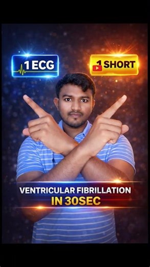 Ventricular Fibrillation ECG ⚡ Deadliest Rhythm You Must Know | FMGE NEET-PG USMLE #shortsfeed #ecg