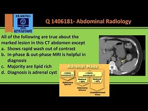 Adrenal adenoma Radiology - Algorithm to identify